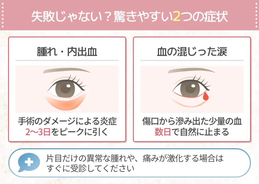 クマ取り後のダウンタイムがひどい!この症状は失敗?