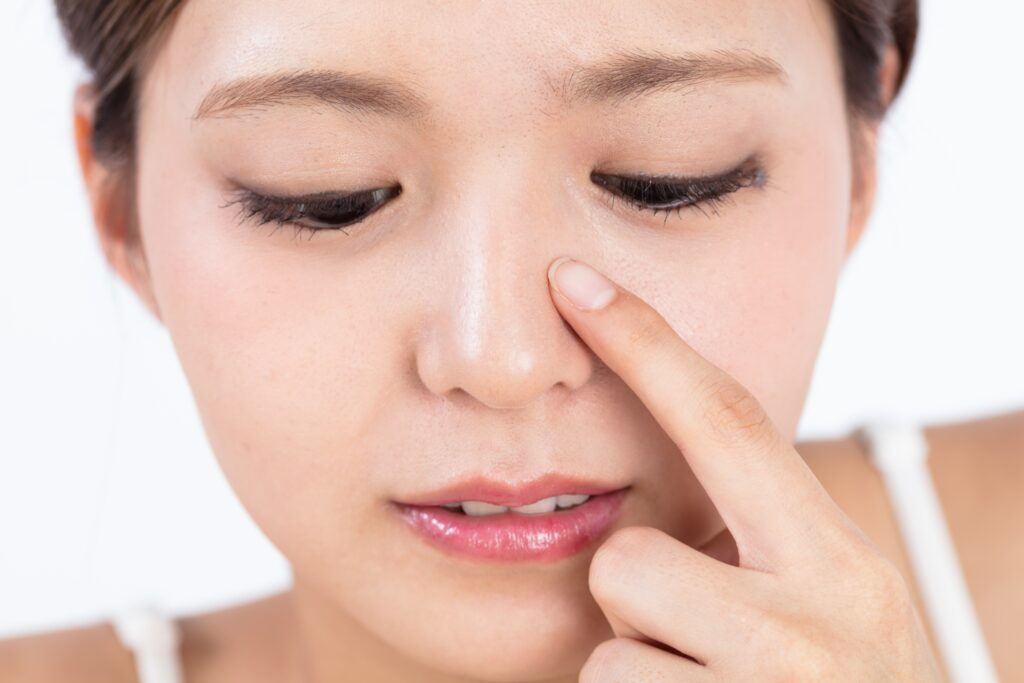 いちご鼻の原因と治療法を美容皮膚科が徹底解説｜毛穴の黒ずみを根本改善するには？