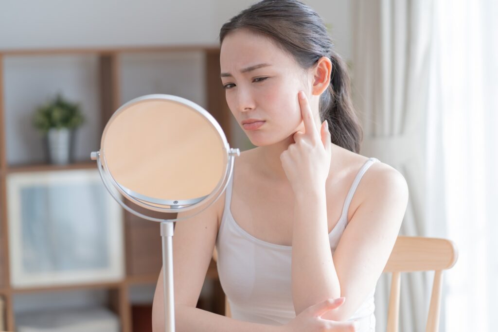 シミ取りレーザー後の経過は？赤み・かさぶた・色素沈着の対処法やダウンタイムも解説