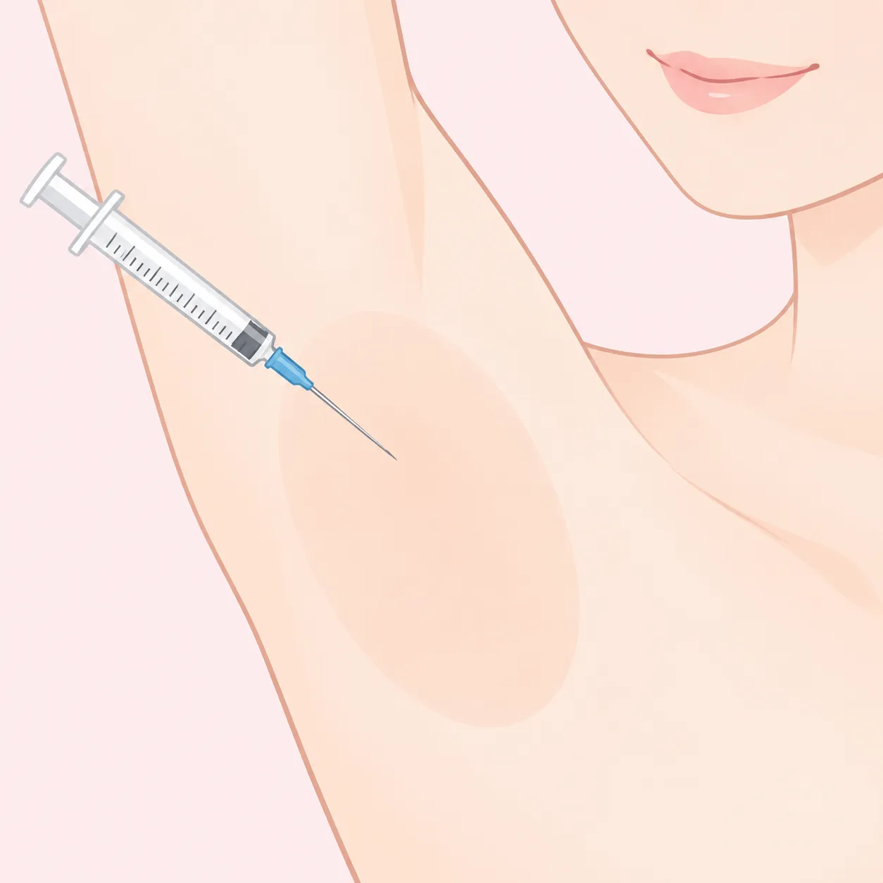 1. 麻酔