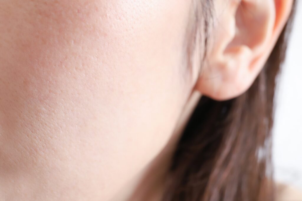 イソトレチノインで角栓が出てくるのはなぜ？好転反応との違いと正しい対処法