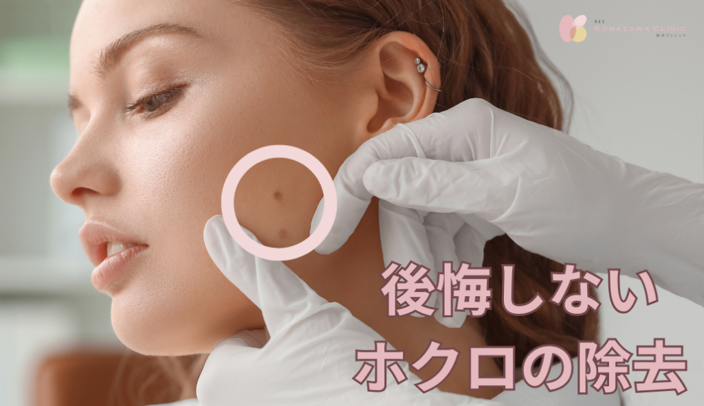 後悔しないホクロ除去｜3つの治療法から経過、ダウンタイムまで医師が全解説｜駒沢大学駅から徒歩1分ネス駒沢クリニック