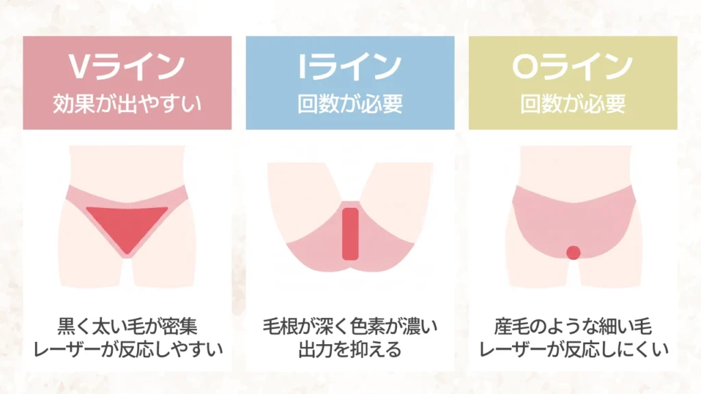 部位ごとに異なる効果の出やすさと必要な回数