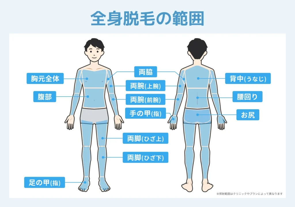全身脱毛でおすすめのクリニック