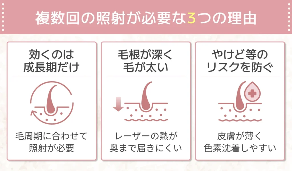 VIO医療脱毛で複数回照射が必要な理由