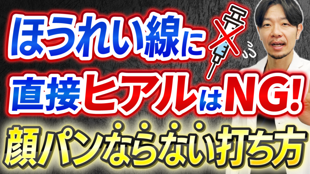 ほうれい線を埋めるだけでは逆効果？自然に若返るヒアルロン酸治療のこだわりを徹底解説