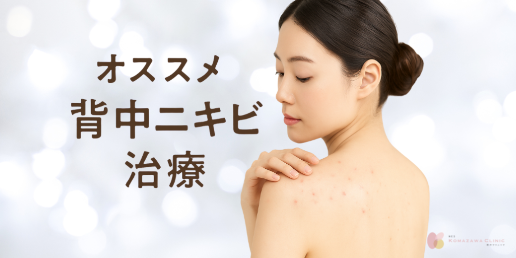 背中ニキビの原因と治療法〜自宅ケアで治らないなら美容医療でのアプローチ〜