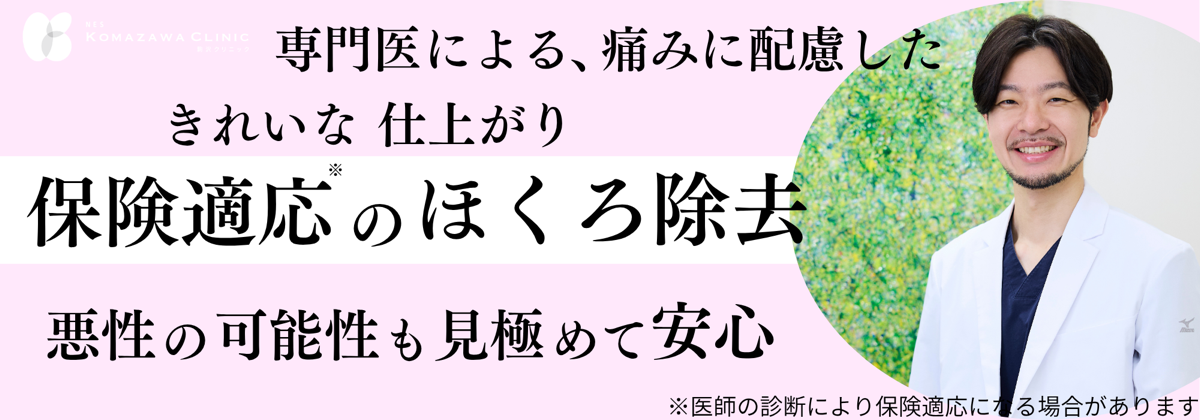 ホクロ除去
