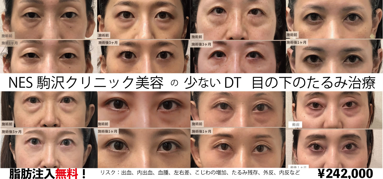 脱脂はNES駒沢クリニック