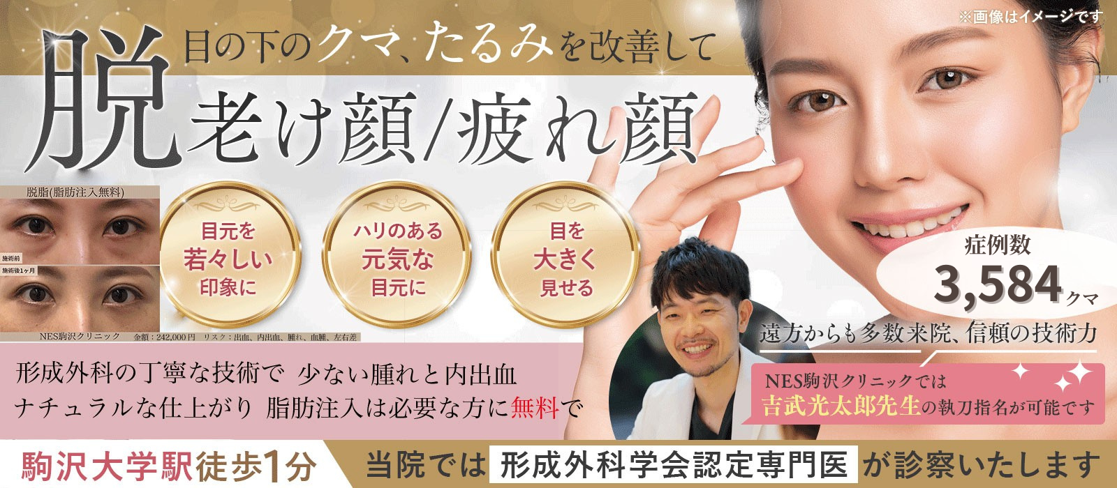東京・世田谷・駒沢で目の下のたるみ・目の下のクマ・クマ取り治療を提供しているネス駒沢クリニックのファーストビュー