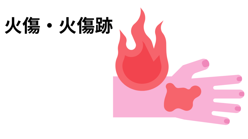 火傷（やけど）
