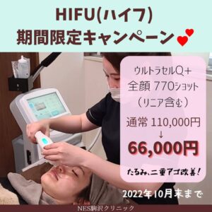 HIFU（ハイフ）ウルトラセルQ＋ キャンペーン | NES（ネス）駒沢 