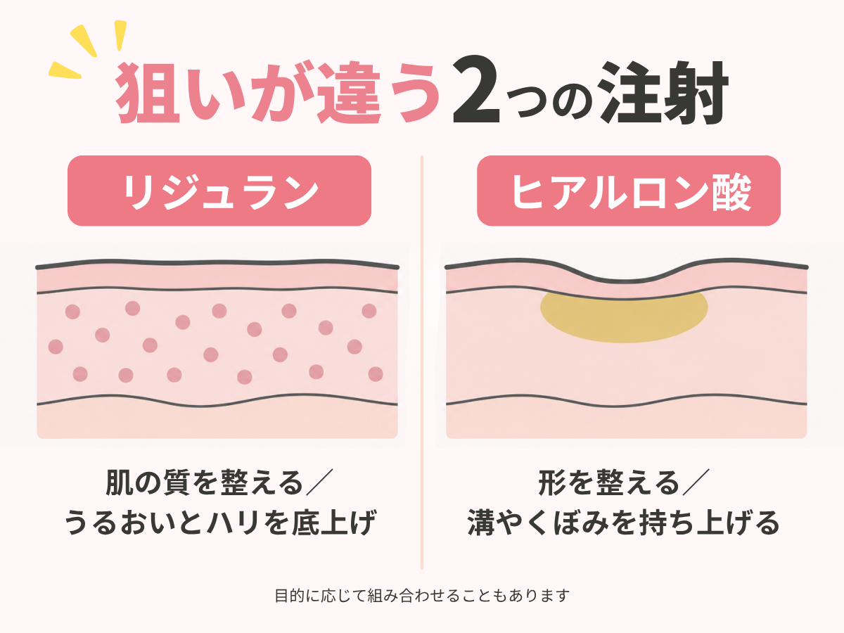 リジュランとヒアルロン酸の狙いの違いを示した図