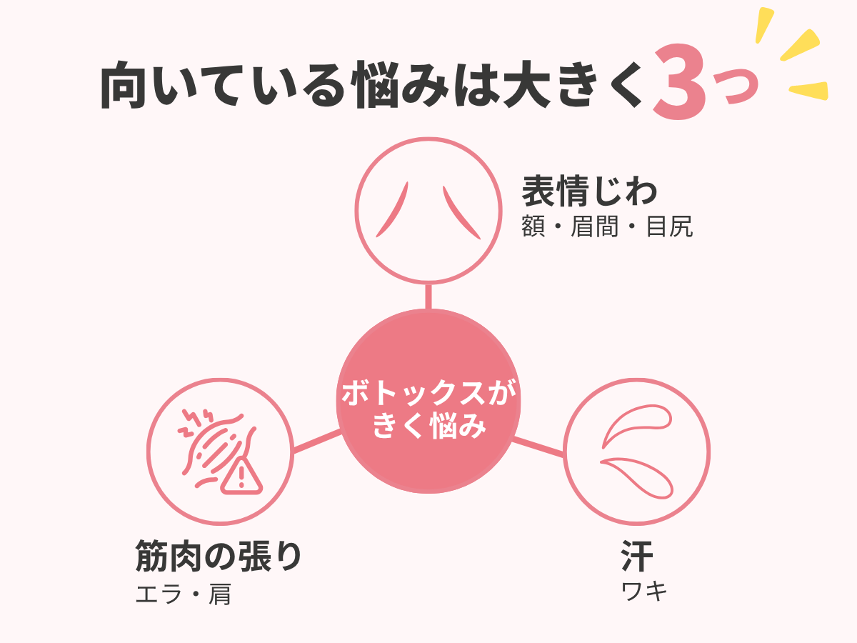 表情じわと刻まれたしわの違いを示した図