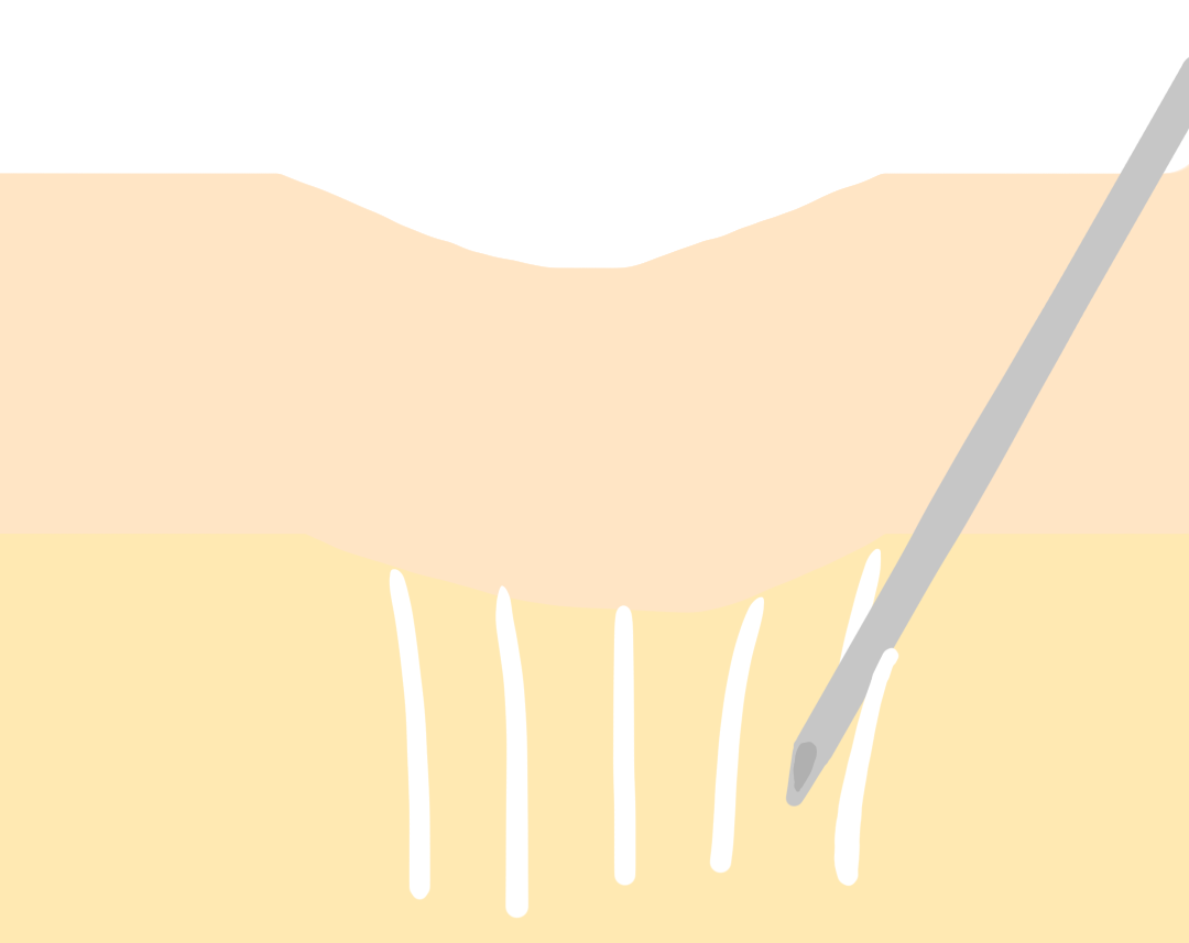 副作用は何ですか?