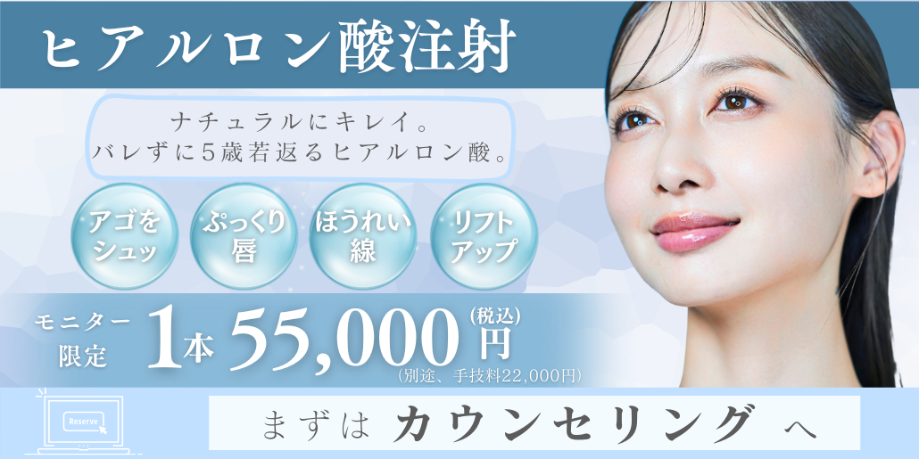 ヒアルロン酸注射